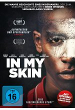 In my Skin DVD-Cover